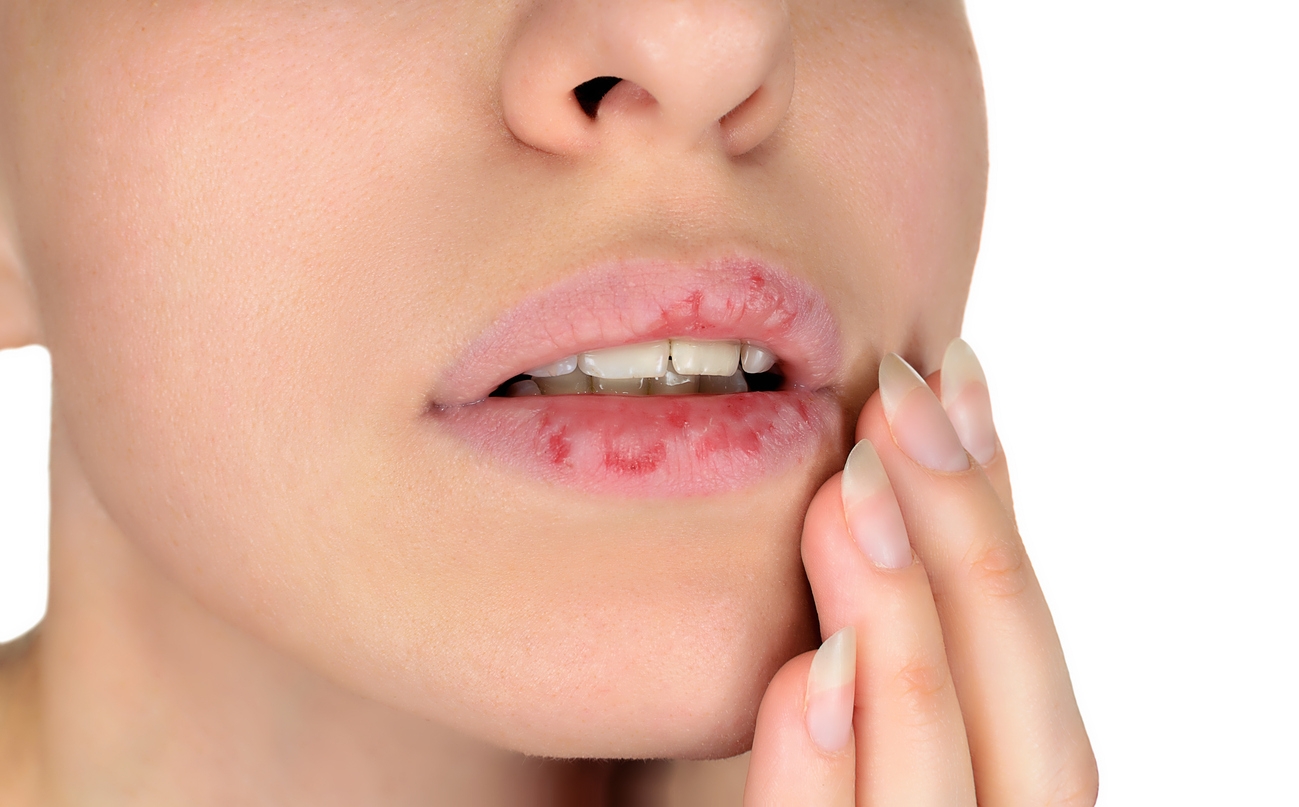 Bibir Kering saat Puasa? Ini 5 Lip Balm yang Bisa Melembapkan Bibirmu!
