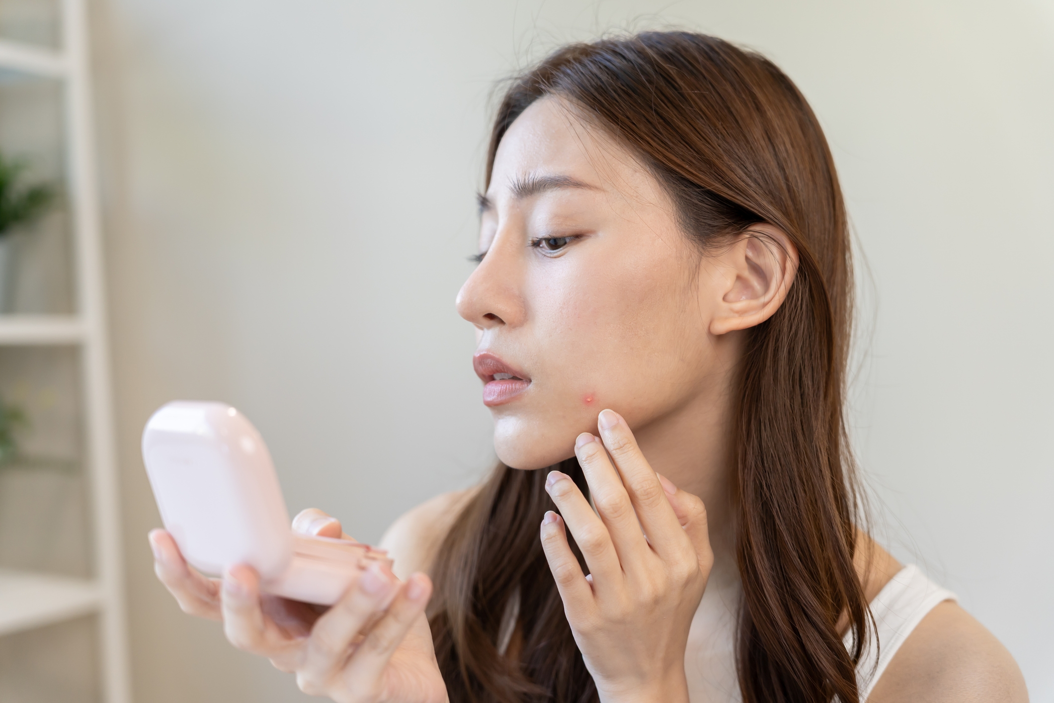 Jerawat Muncul Setelah Lebaran? Ini 5 Cara Simpel untuk Bantu Tenangin Kulit