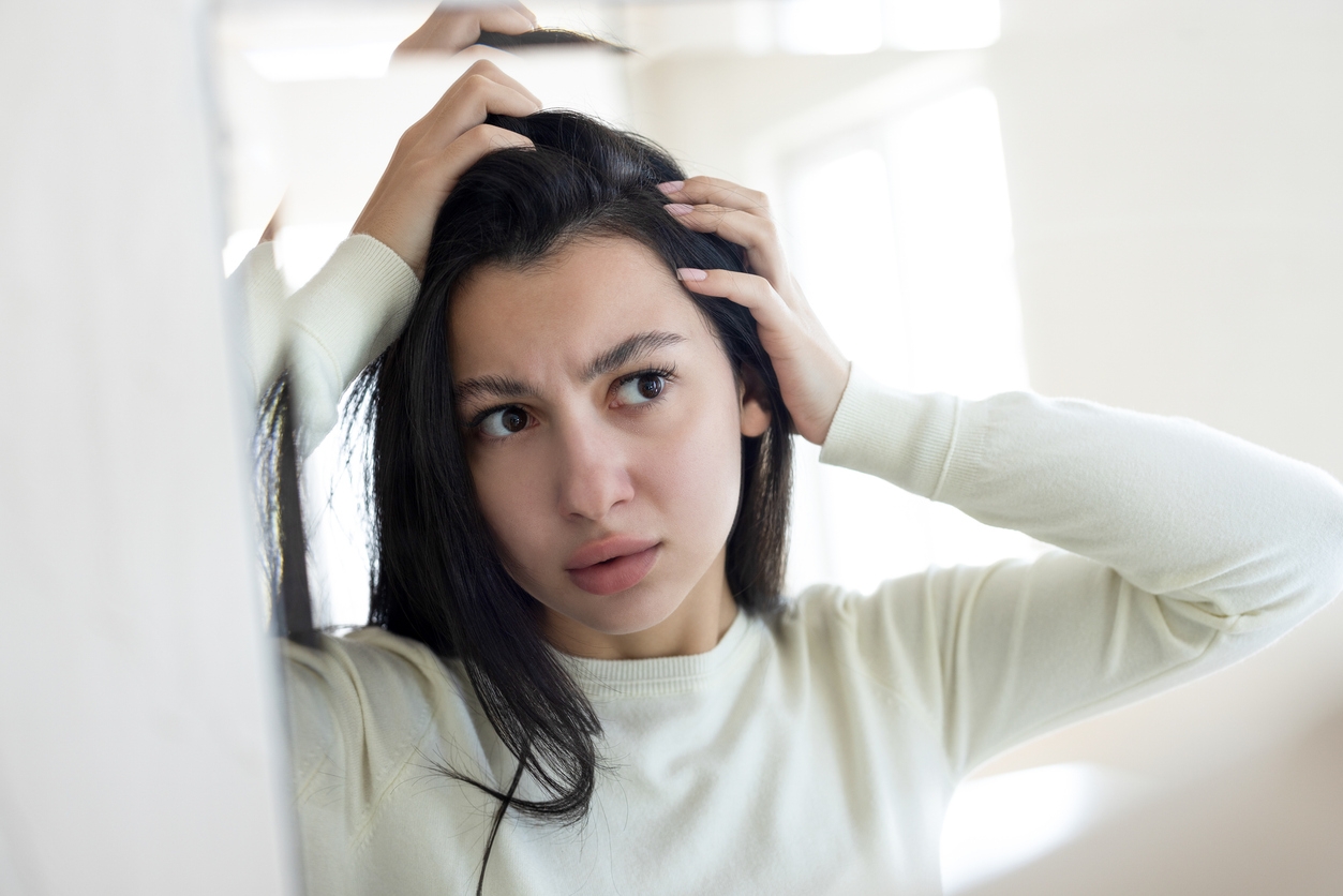 Ketombe Susah Hilang? Ini Cara Menguranginya dan 3 Shampoo yang Bisa Dicoba